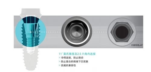 柯威尔种植体是哪国的？韩系中高端品质植体