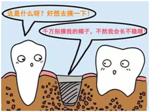 国内种植牙技术成熟吗？技术背景+临床成效+设备支持+患者反馈了解更真实