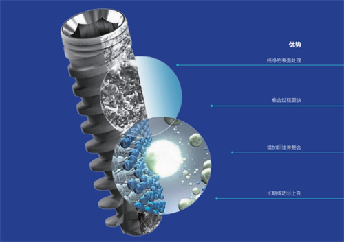 植体干货！为您分享以色列雅定种植体介绍：品牌优势+型号特点+适应症+解决方案一览