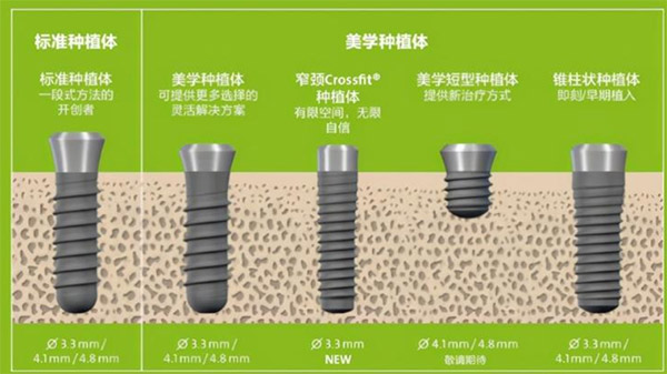 种植牙选哪个品牌好?看种植牙建议买的三个品牌是谁!