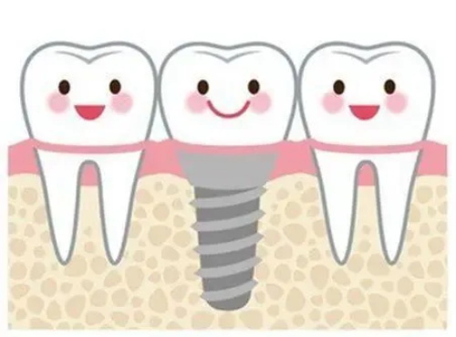 江门德佰年口腔种牙的示意图