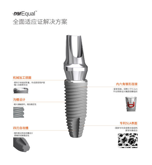 百齿泰DMEqual种植体优势介绍图