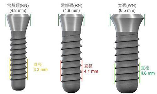 上海虹口区种牙价格表新出：国产/进口植体价格都有