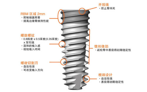 奥齿泰优势有哪些