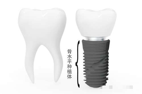 种植牙多少钱一颗？2024-2025年价格表公布！