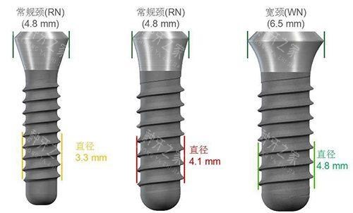 种植牙尺寸规格种类图