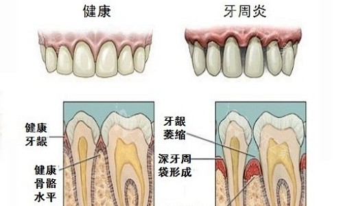 泰州种牙哪家好？种植牙在泰州这些牙科放心去！