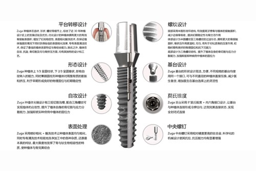 德国儒伽种植体优势特点图