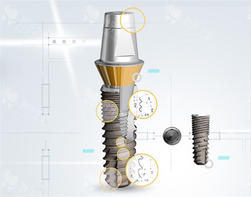 登特斯种植牙植体表面和基台设计放大