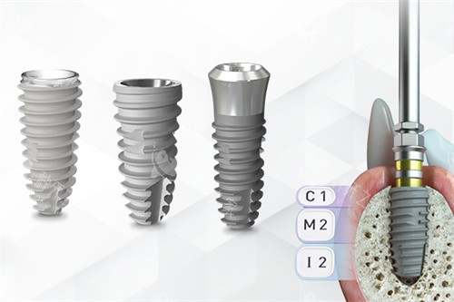 韩国纽百特种植牙不同型号