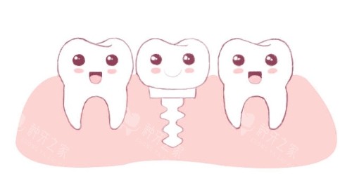 大理美伢口腔种植牙性价比高！1980元起！